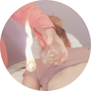 Tracy performing cupping method with fire-glass